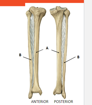 <p>A: Tibia: </p><ul><li><p> lies medially</p></li><li><p>proximally more expanded</p></li><li><p>articulates proximally with femur</p></li></ul><p>B : Fibula: </p><ul><li><p>lies laterally </p></li><li><p>doesn’t articulate proximally with femur</p></li></ul>
