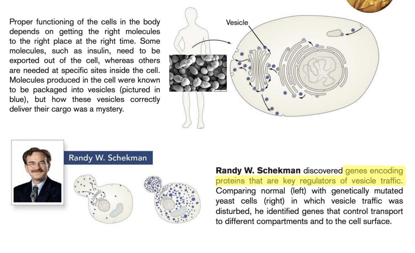 <ul><li><p>genes encoding proteins are key regulators of vesicle traffic</p></li><li><p><span style="background-color: inherit; line-height: 19.55px; color: windowtext;"><span>Dude discovered the vesicles</span></span><span style="line-height: 19.55px; color: windowtext;"><span>&nbsp;</span></span></p></li><li><p class="Paragraph SCXO34109798 BCX0" style="text-align: left;"><span style="background-color: inherit; line-height: 19.55px; color: windowtext;"><span>Uses yeast (fungal spores)</span></span><span style="line-height: 19.55px; color: windowtext;"><span>&nbsp;</span></span></p></li><li><p class="Paragraph SCXO34109798 BCX0" style="text-align: left;"><span style="background-color: inherit; line-height: 19.55px; color: windowtext;"><span>Discovered genes that encode protei</span></span><span style="line-height: 19.55px; color: windowtext;"><span>n</span></span></p></li><li><p class="Paragraph SCXO34109798 BCX0" style="text-align: left;"><span style="background-color: inherit; line-height: 19.55px; color: windowtext;"><span>If you destory the gene&nbsp;</span></span><span style="line-height: 19.55px; color: windowtext;"><span>&nbsp;</span></span></p><ul><li><p class="Paragraph SCXO255234909 BCX0" style="text-align: left;"><span style="background-color: inherit; line-height: 19.55px; color: windowtext;"><span>Organized delivery of produce in cell come to a mass and is not working?</span></span><span style="line-height: 19.55px; color: windowtext;"><span>&nbsp;</span></span></p></li></ul></li></ul><p></p>