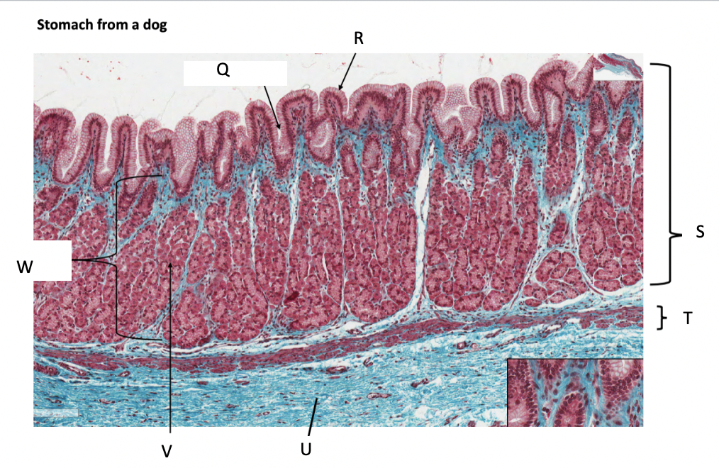 <p>simple columnar epithelium</p>