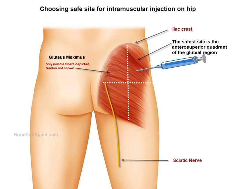 <p>buttocks</p>