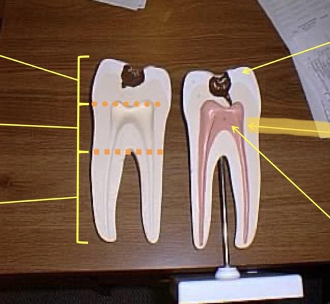 knowt flashcard image