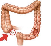 <p>The <strong><em><em></em></strong><strong><em></em></em></strong> is a pouch-like structure attached to the cecum at the beginning of the large intestine that has no significant digestive function in humans.</p>