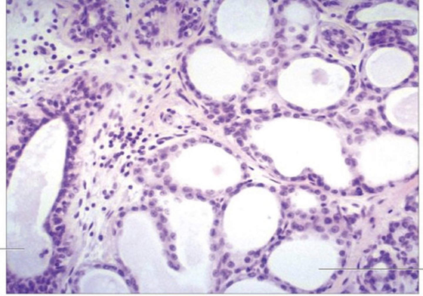 <p>is this mammary gland active or inactive?</p>