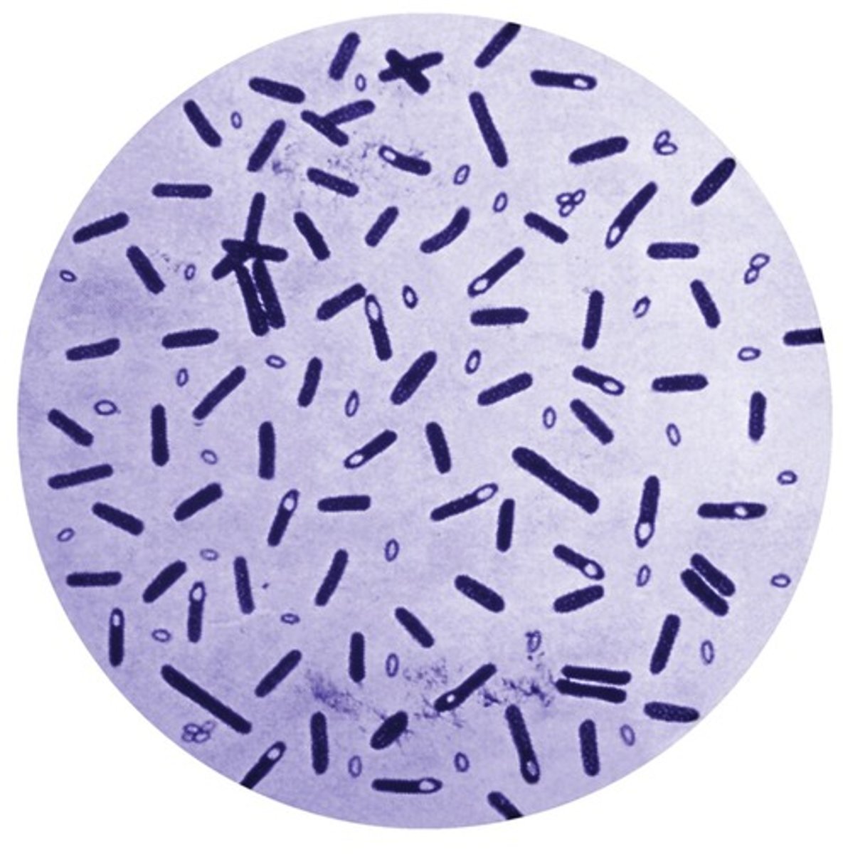 <p>Caused by Clostridium botulinum.</p><p>Causes weakness, trouble seeing, feeling tired, trouble speaking.</p><p>May be followed by weakness of arms, chest muscles and legs.</p><p>Cause of food poisoning.</p>