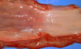 <p>What is this and its cause?</p>