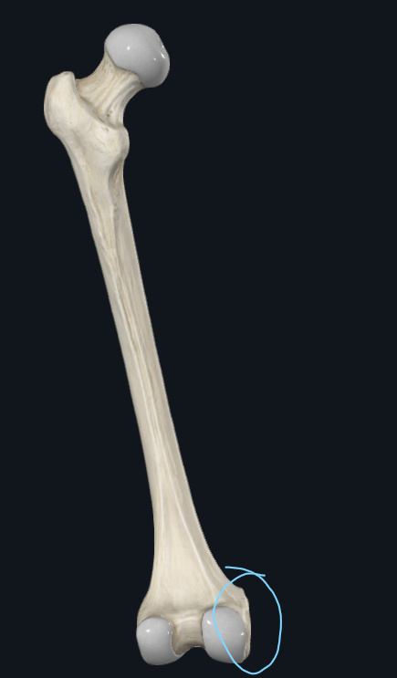 <p>What is this part of the femur called</p>
