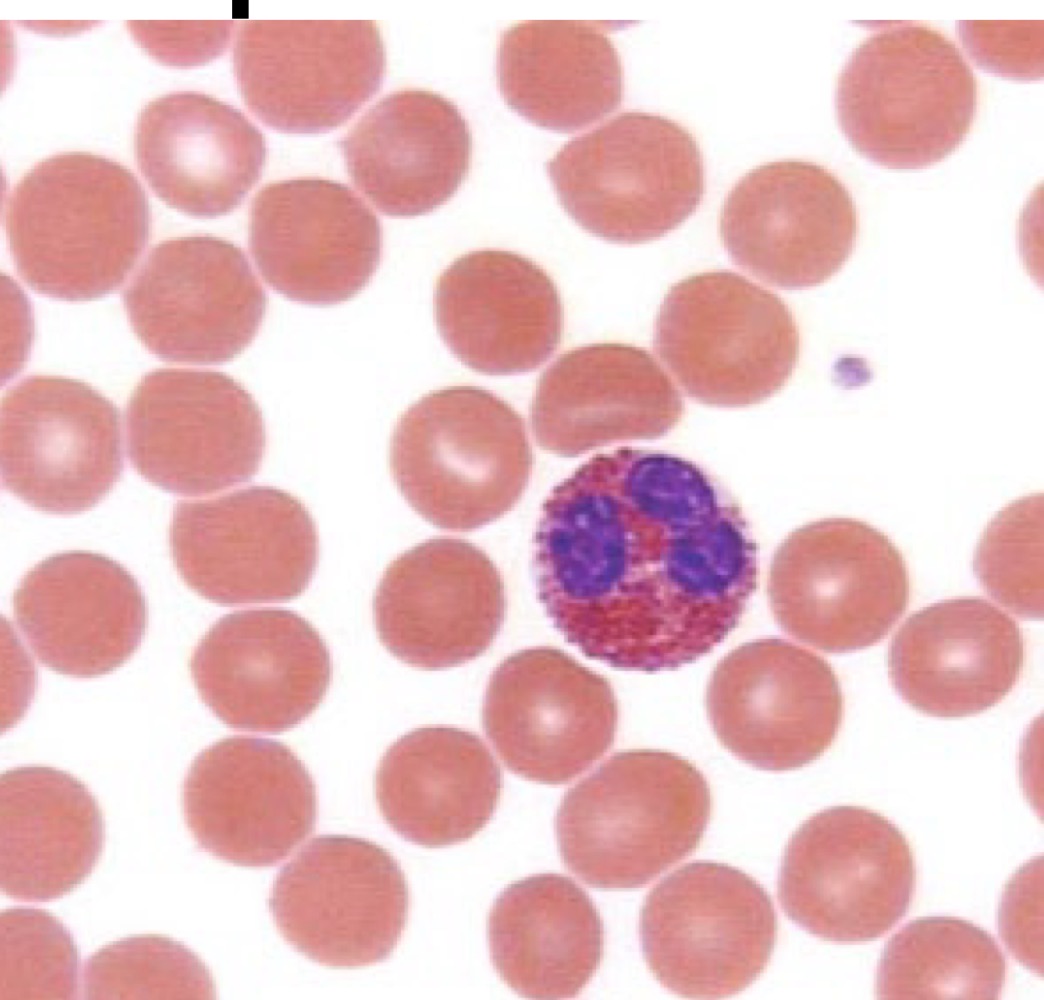 <p>Eosinophils</p>