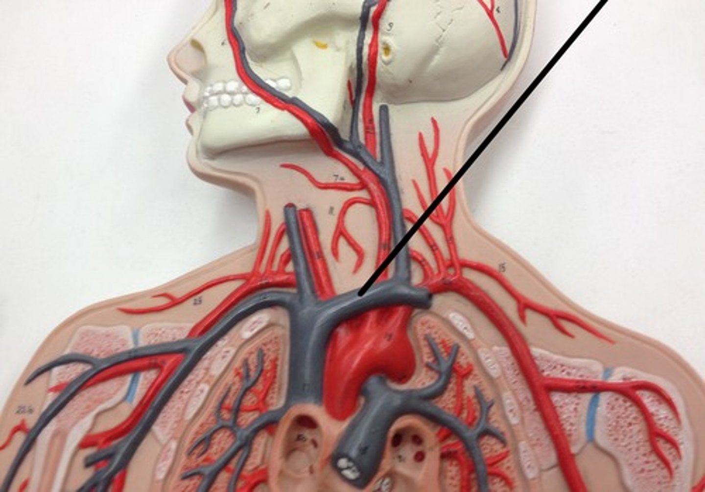 <p>What structure?</p>