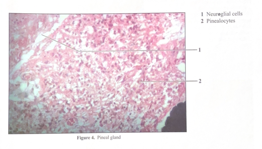 <ol><li><p>Neuroglial cells&nbsp;</p></li><li><p>Pinealocytes&nbsp;</p></li></ol><p></p>