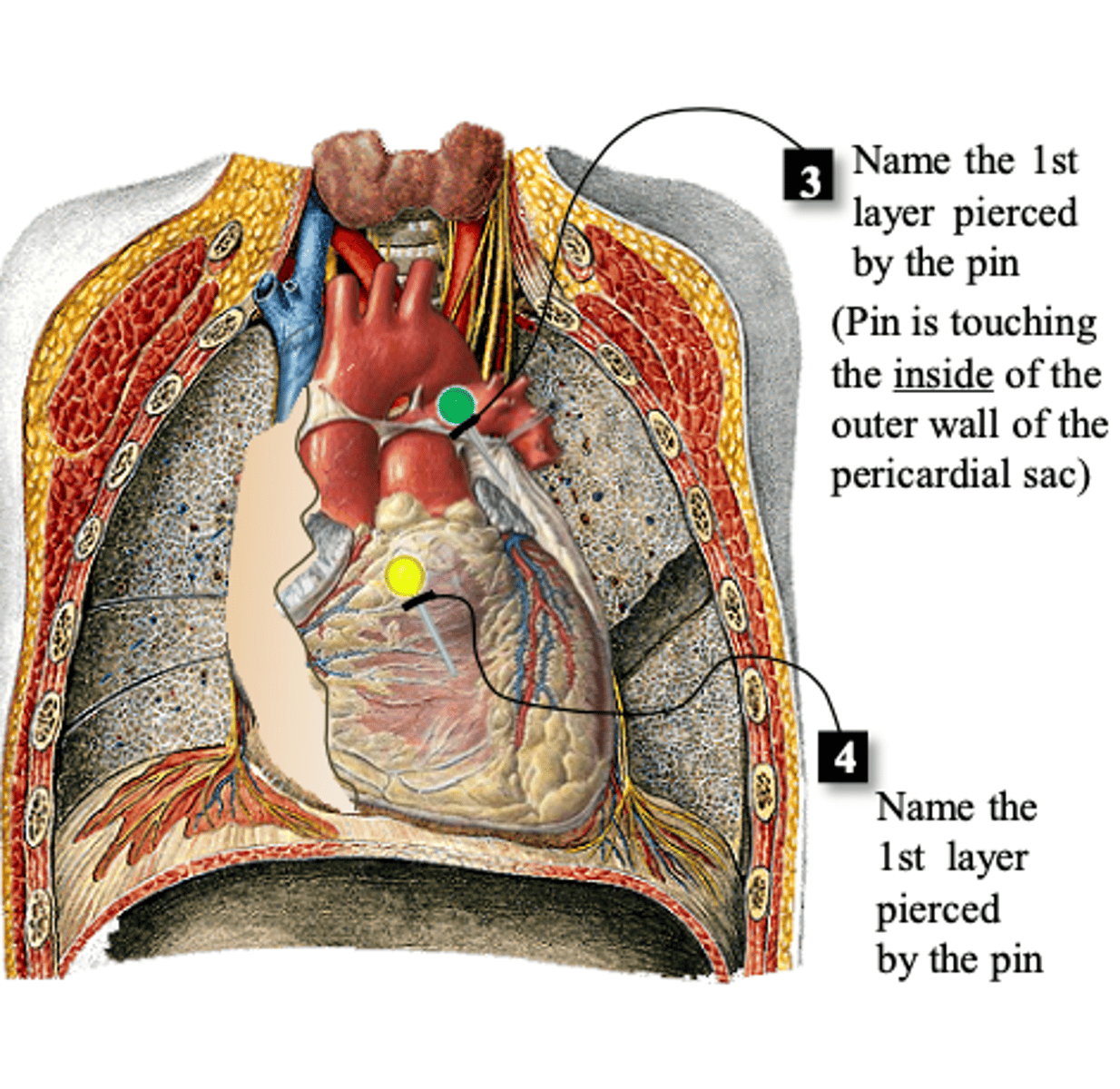 <p>#3</p>