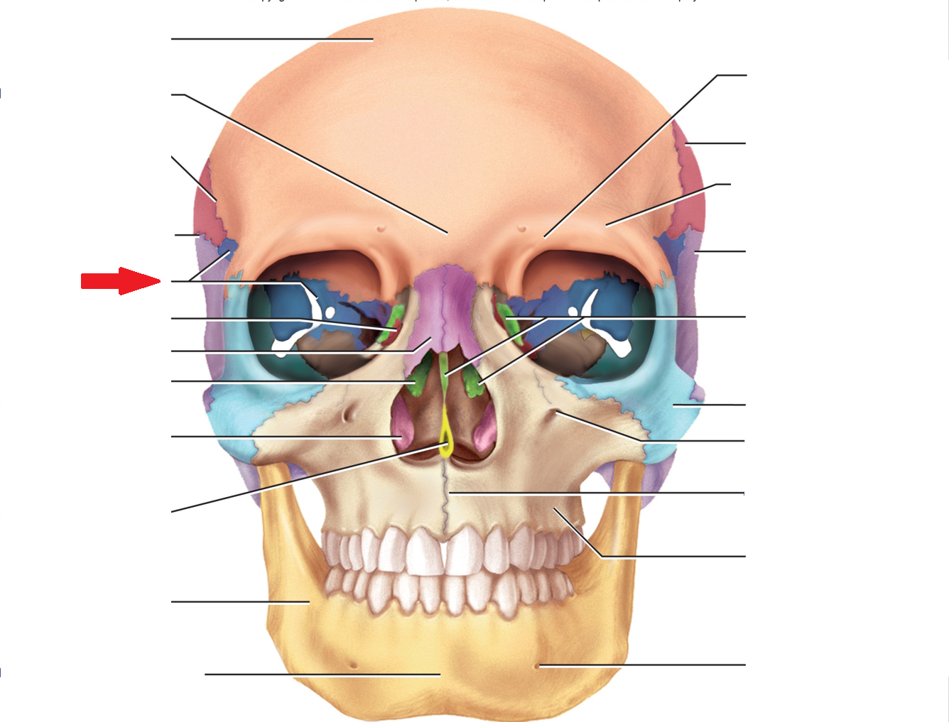 term image