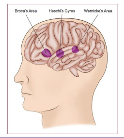 <ul><li><p>In temporal lobe </p></li><li><p>bilateral </p></li><li><p>includes <strong>Heschl’s gyrus </strong></p><ul><li><p>the first area of cortex to process auditory information</p></li><li><p>awareness or perception of sound</p></li></ul></li></ul><p></p>