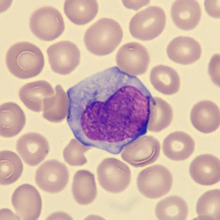 <p>What is this leukocyte showing?</p>