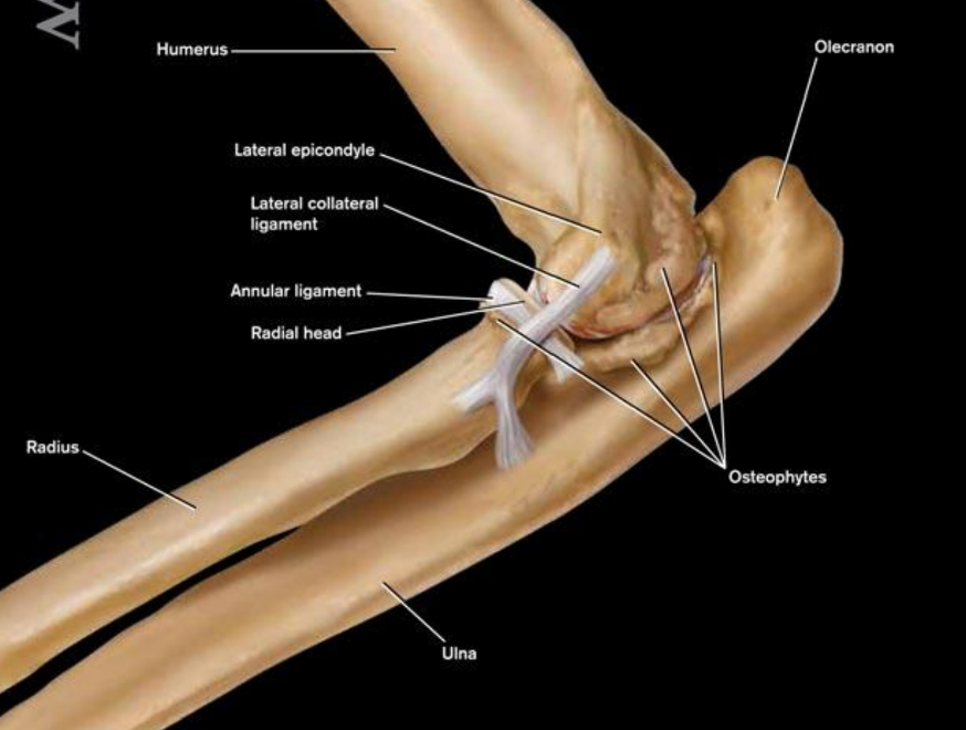 <p>in what 3 joints can ED be seen?</p>