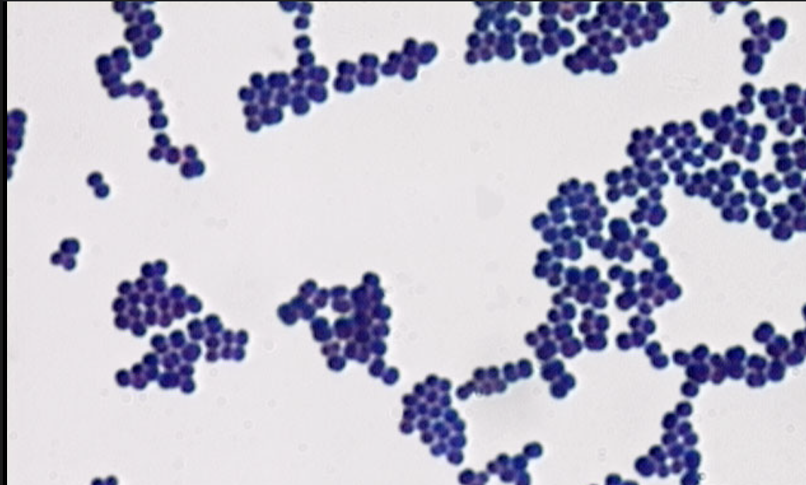 <p>small spheres</p>