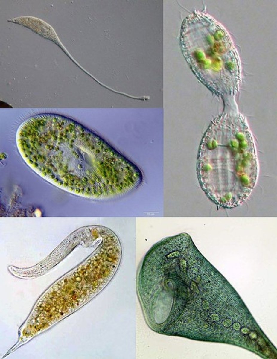 <p>The platonic ideal of a ciliate.</p>
