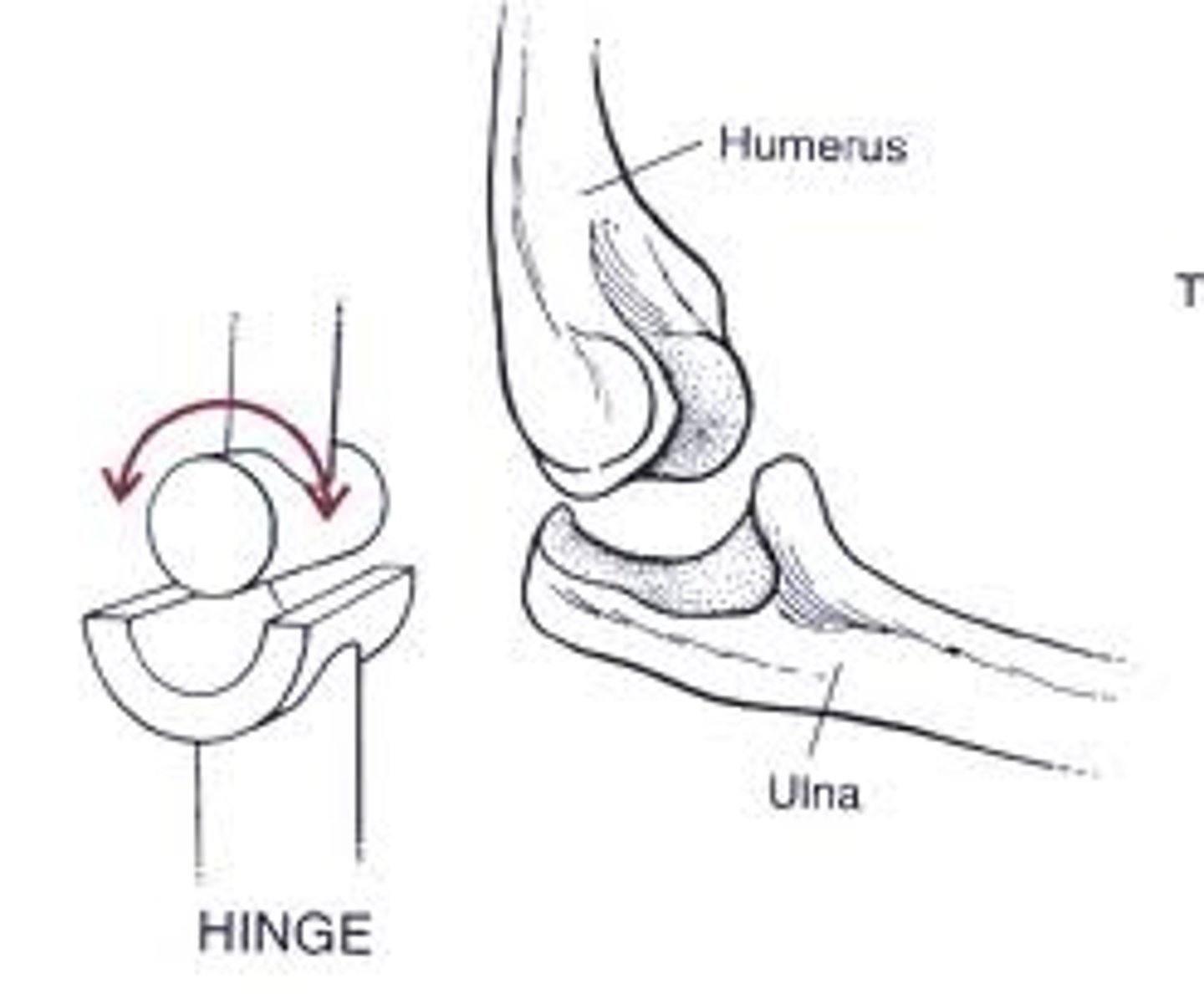 <p>permits movement primarily in one plane—flexion and extension. The articulating surfaces are typically a convex surface fitting into a concave surface</p><p>- ex. humeroulnar joint at the elbow, where the trochlea of the humerus articulates with the trochlear notch of the ulna</p>