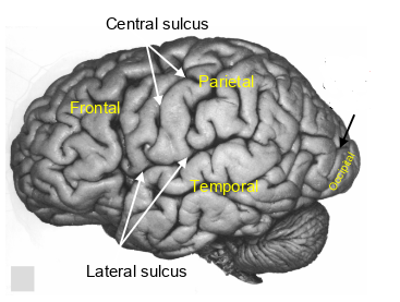 <p>what sulcus is this?</p>