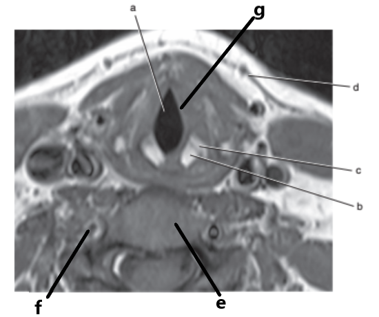 <p>What is letter a ?</p>