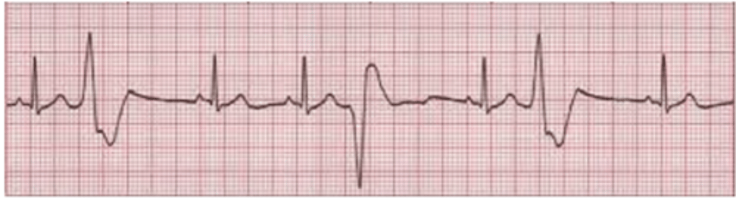 <p>Rhythm?</p><p>Management?</p>