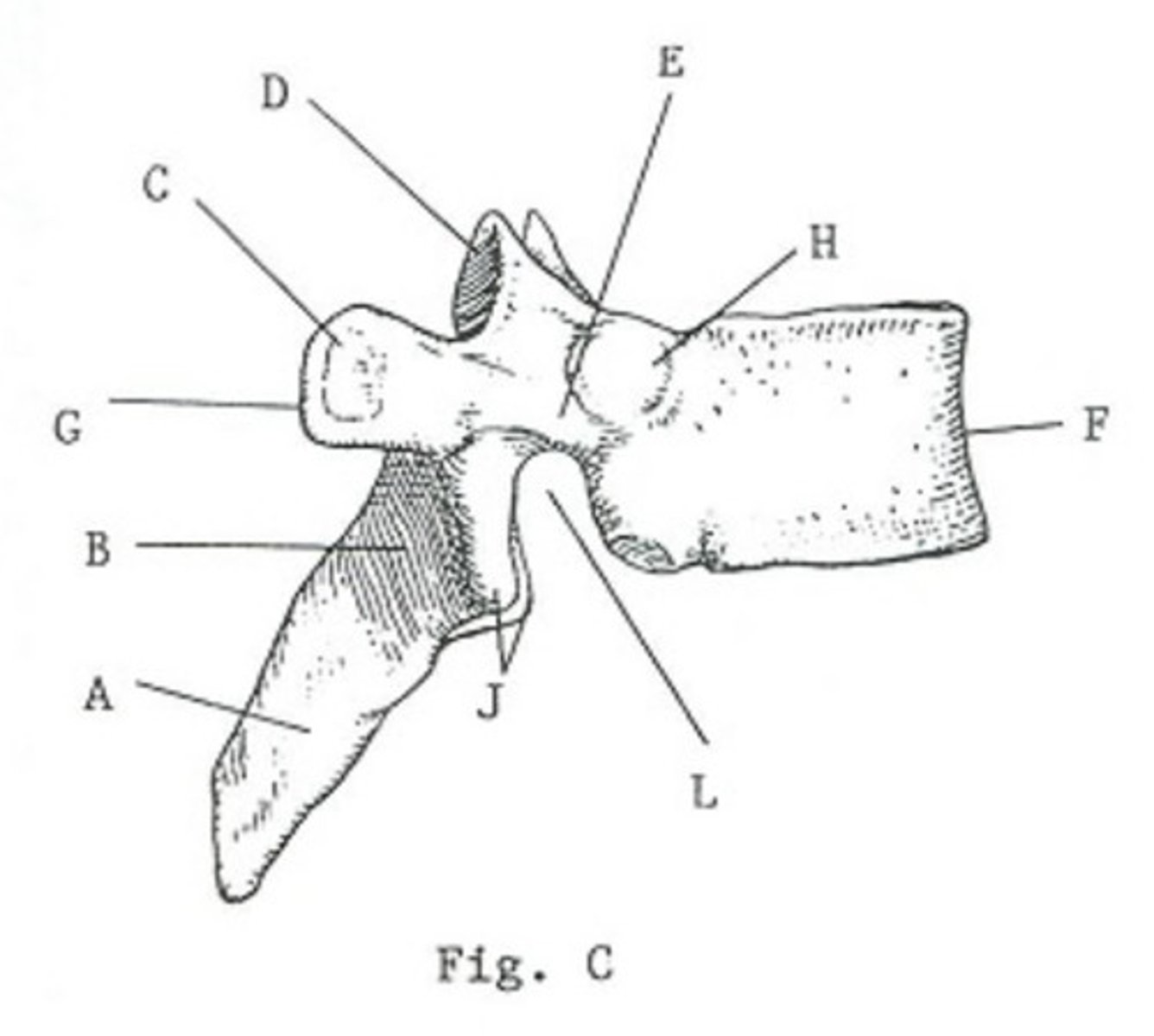 <p>What vertebral level is represented here?</p><p>cervical</p><p>thoracic</p><p>lumbar</p><p>pelvic</p>