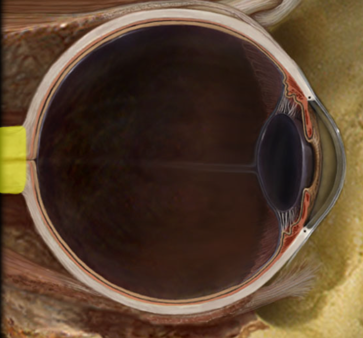 term image