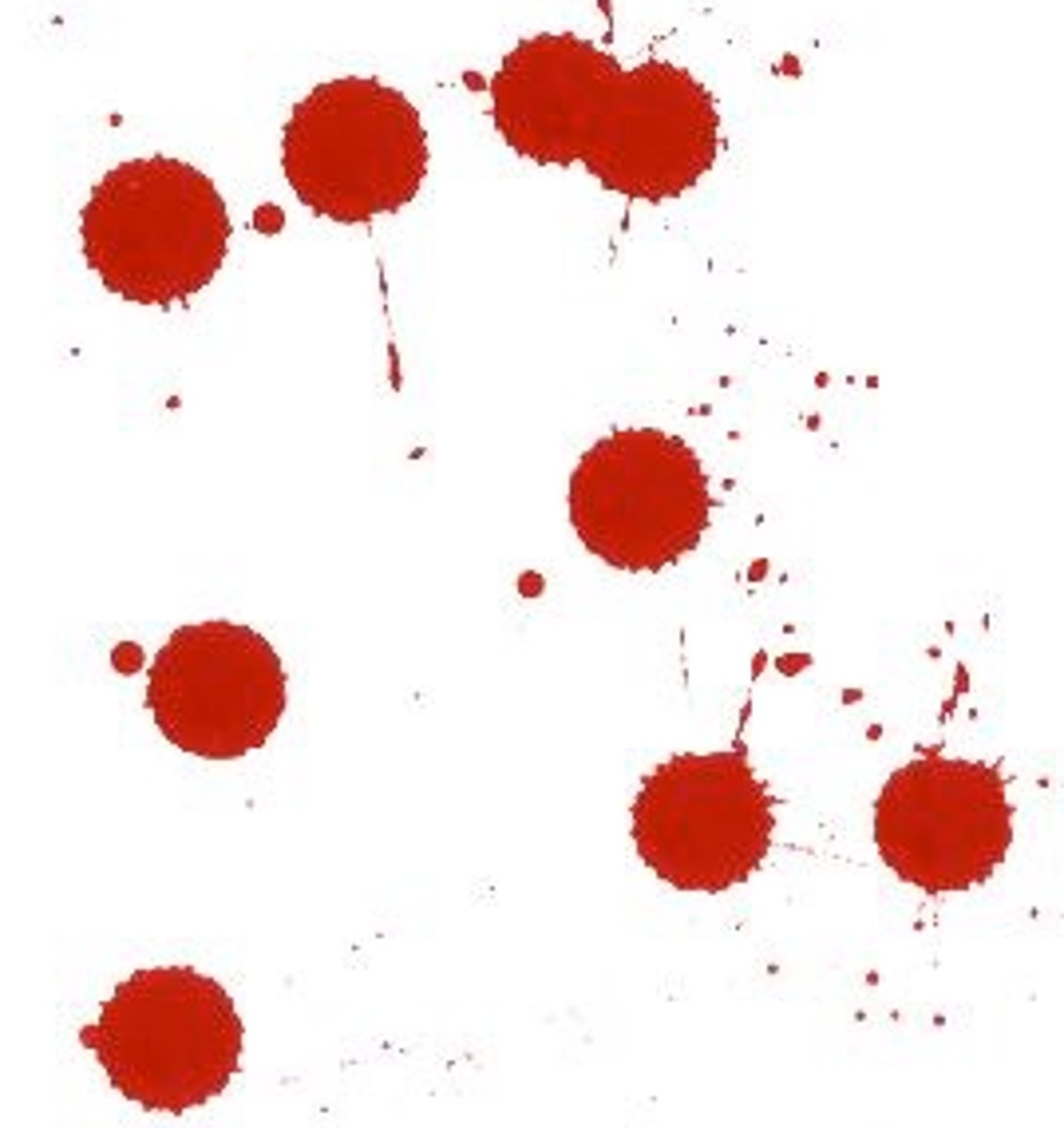 <p>typically result from gravity acting on an injured body</p><p>- Drops</p><p>- Flows</p><p>- pools</p>