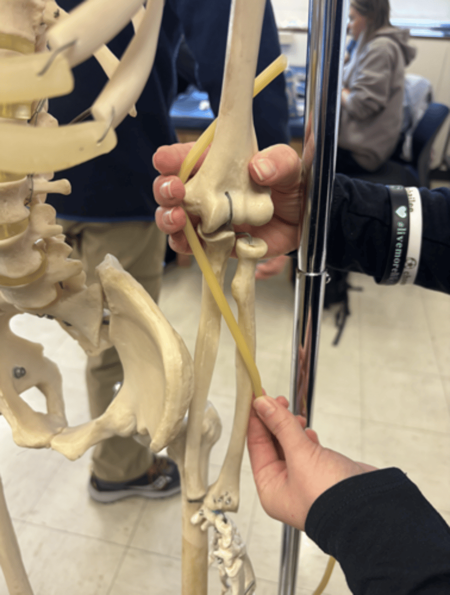 <p>What is this muscle?</p>