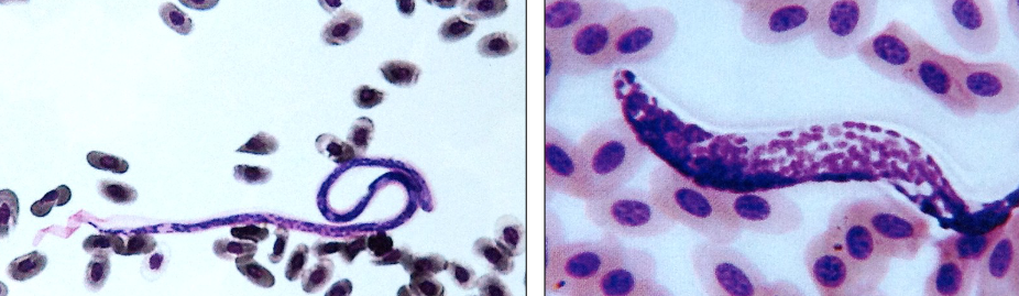 <p>When talking about hemoparasites, what is this?</p>
