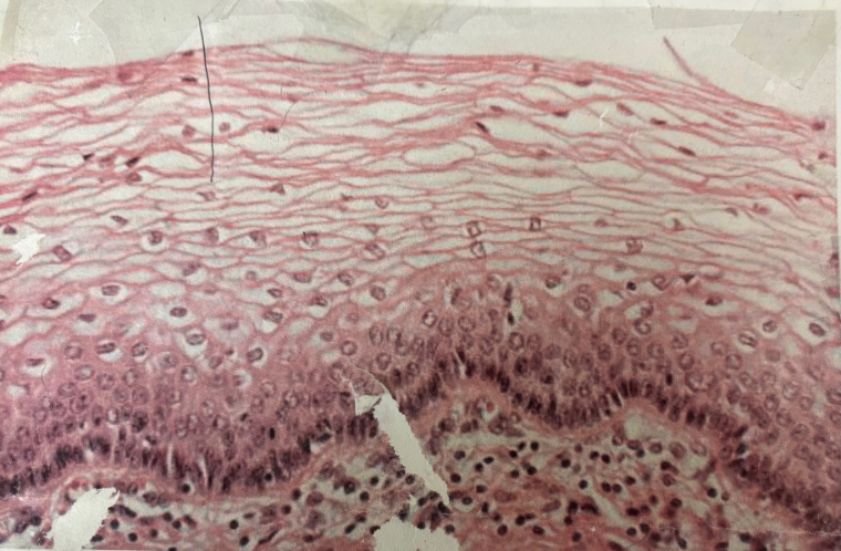 <p>What kind of tissue/cartilage is this? </p>