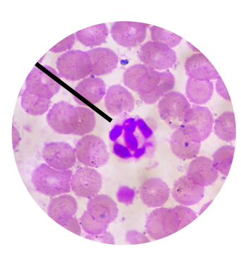 <p>what kind of white blood cells is this?</p>