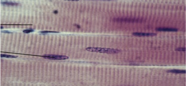 <p>a type of muscle tissue that is striated and under voluntary control. It is responsible for the movement of the skeleton and is composed of long, multinucleated fibers. </p>