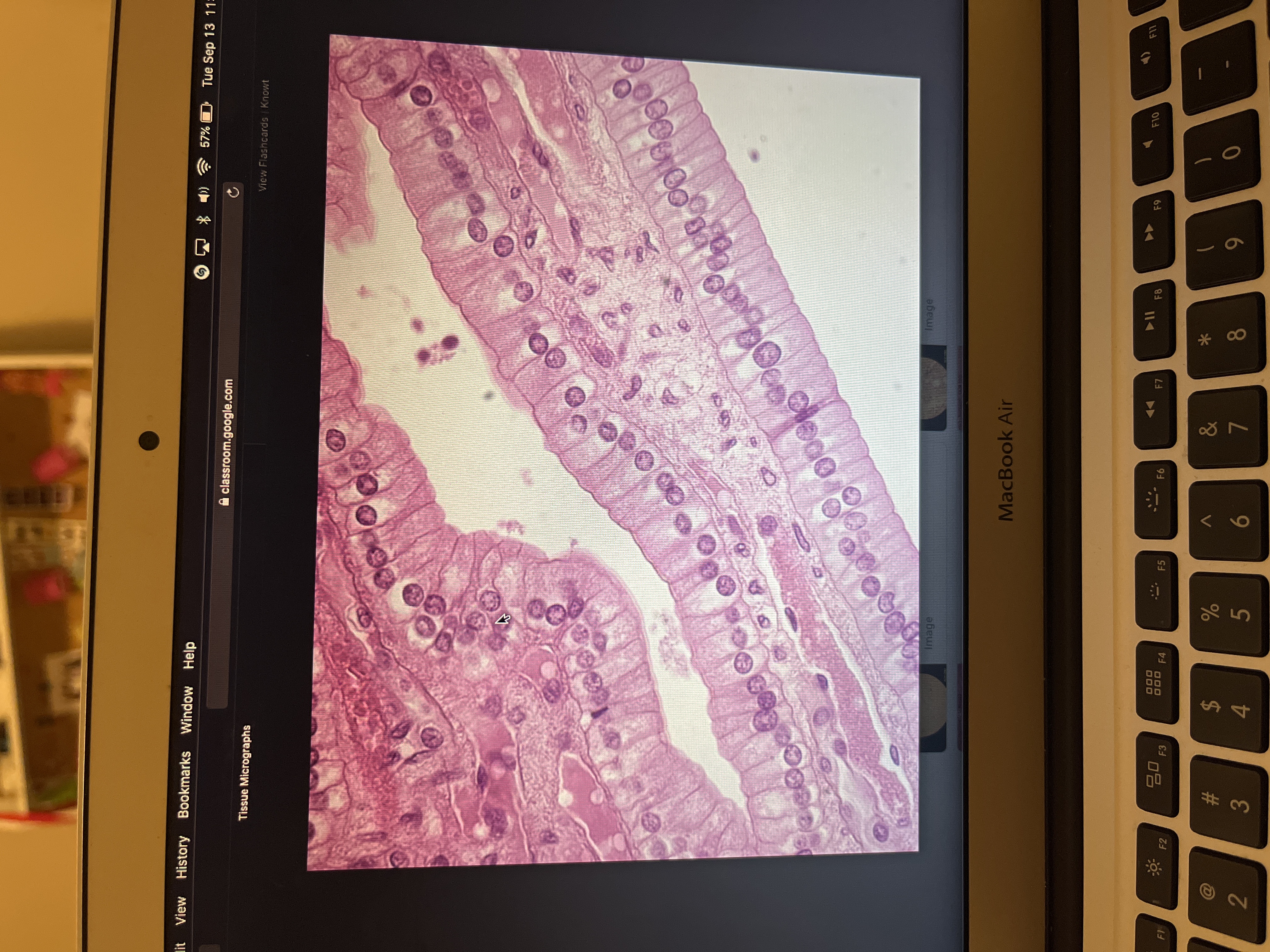 Location: line gastrointestinal  
Function: secretion and absorption