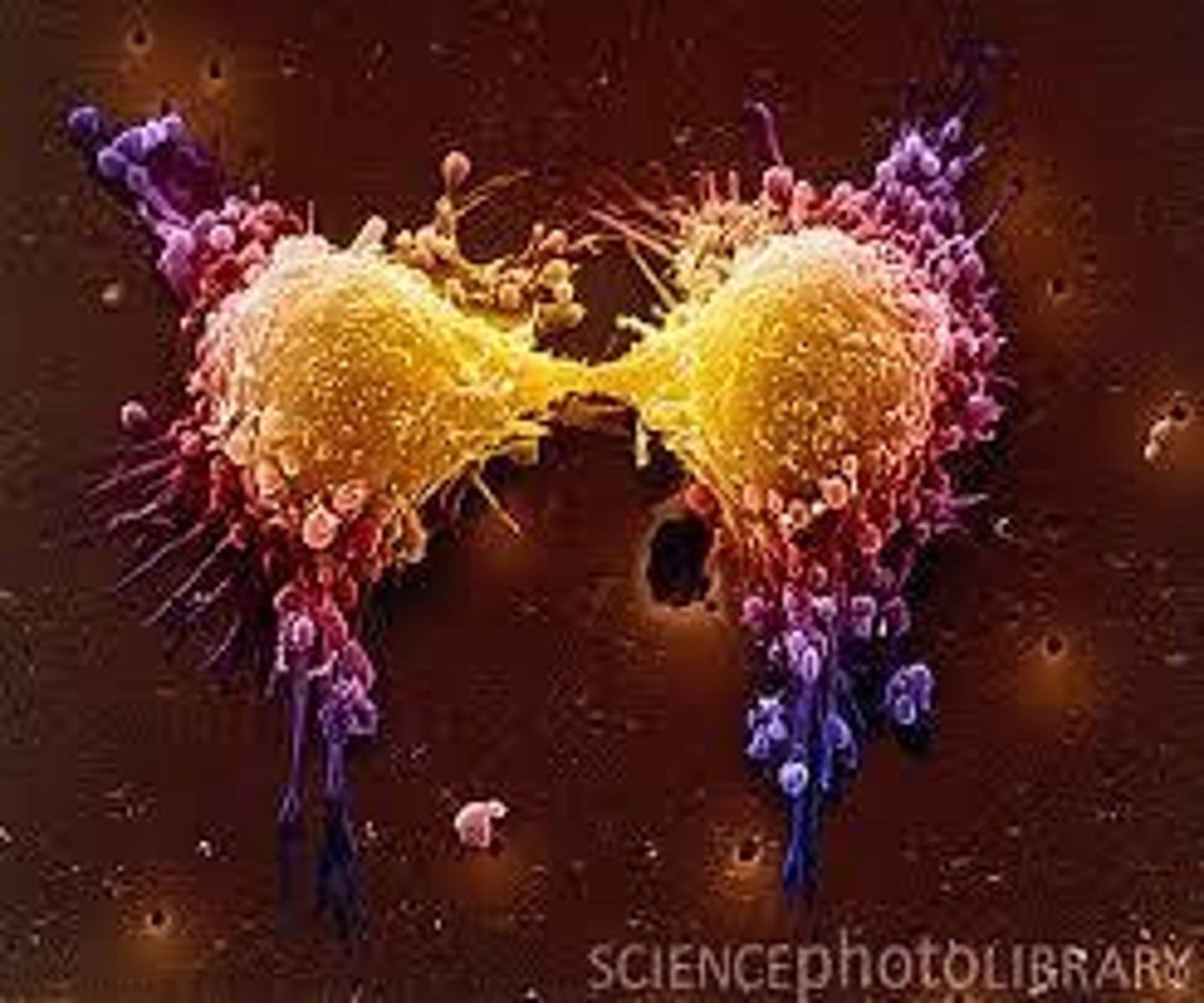 <p>Uncontrolled cell division leading to tumor formation.</p>