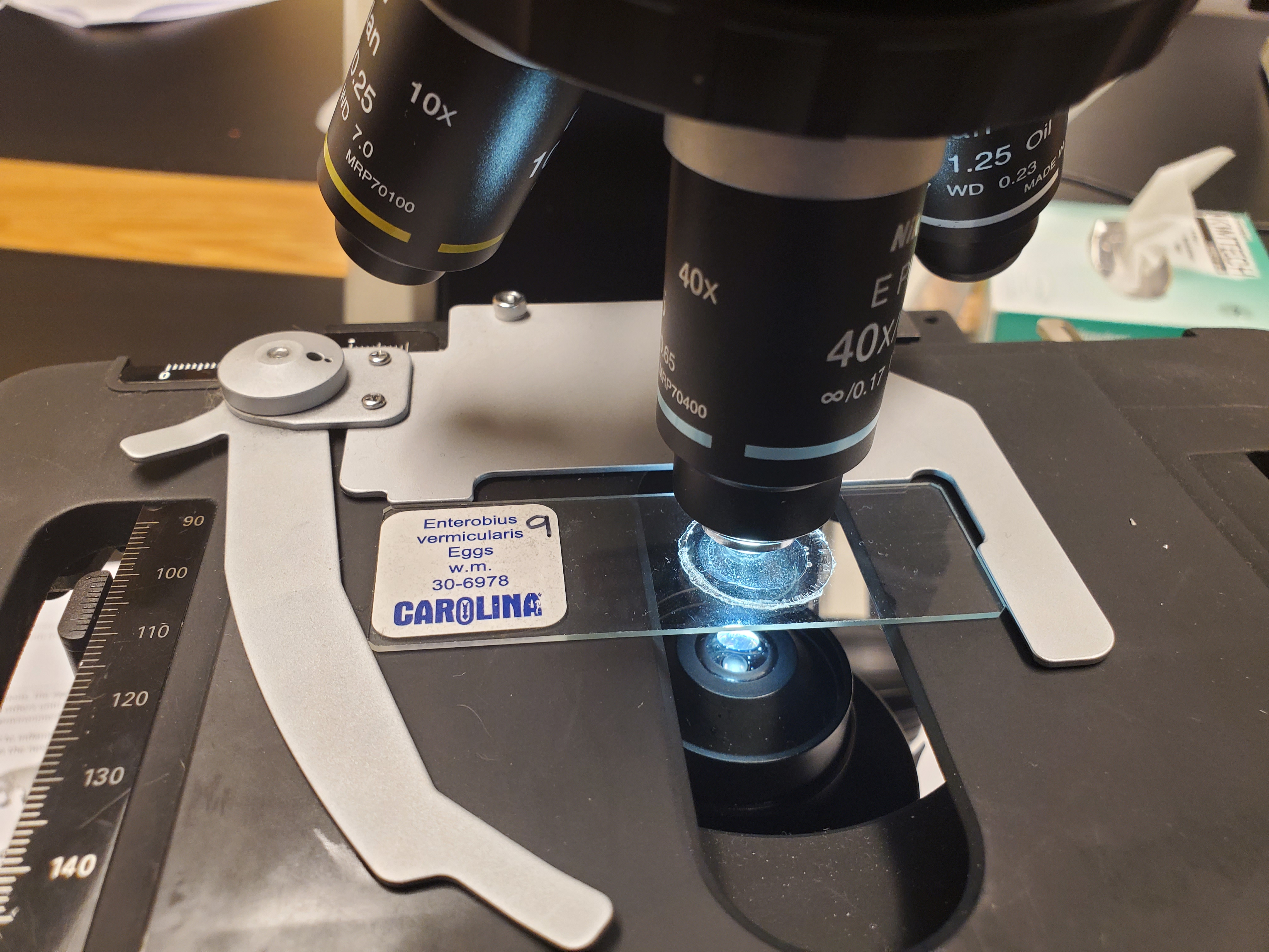 <p>Enterobius vermicularis Eggs</p>