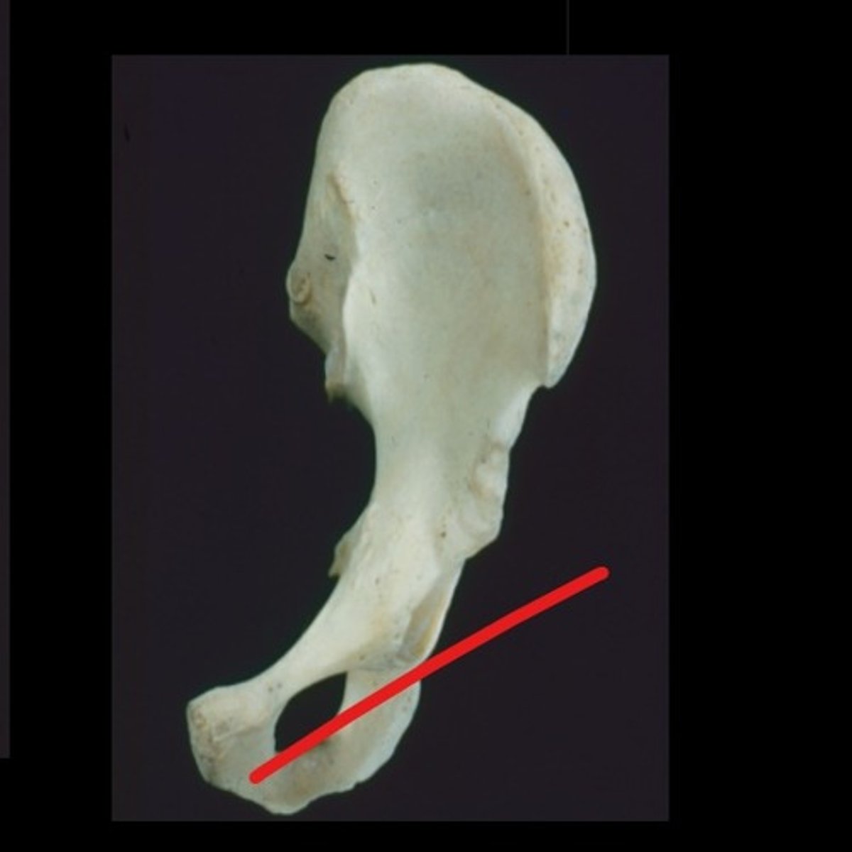 <p>right or left?</p>