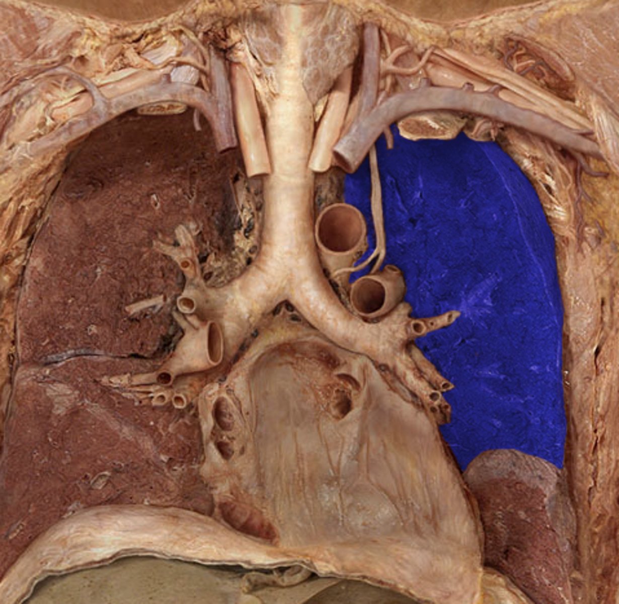 <p>Label the Lung Segment</p>
