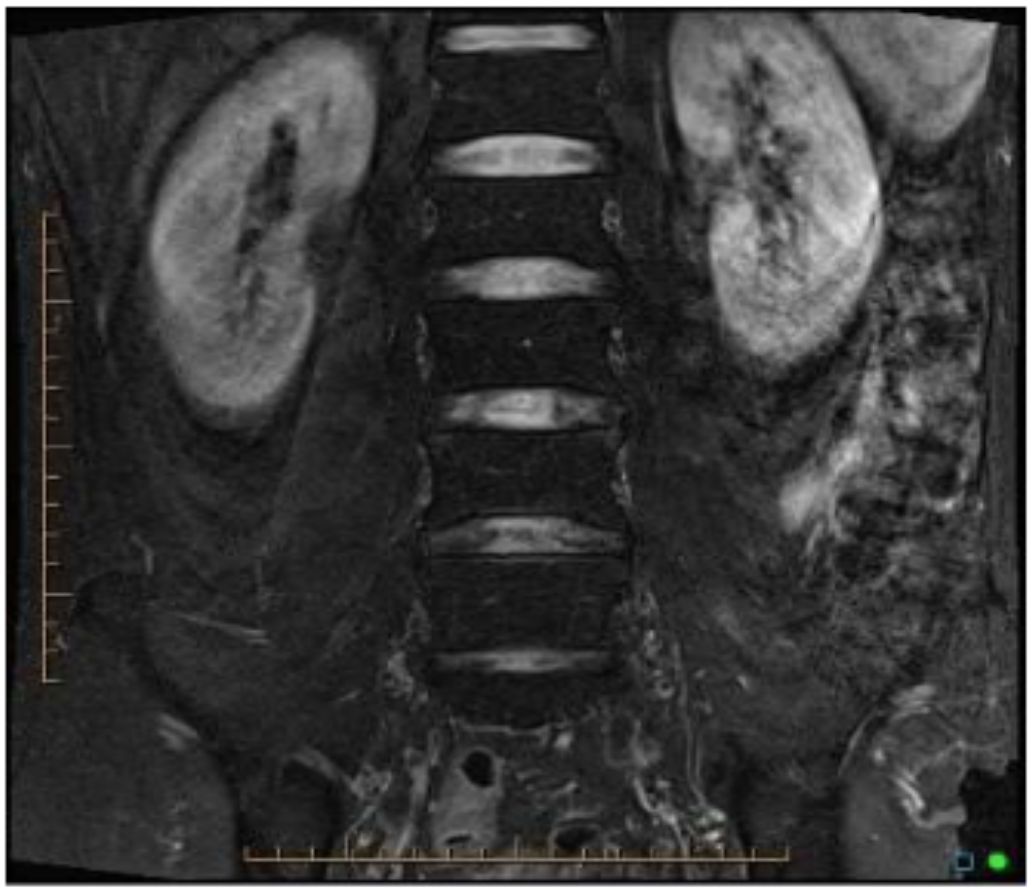 <p>What is the image weighting of this slice?</p>