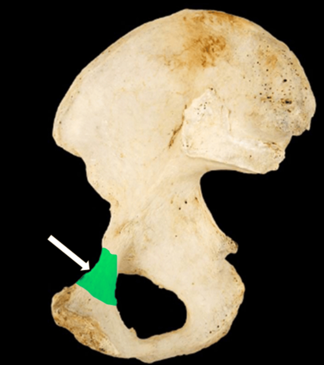 <p>name the part</p>