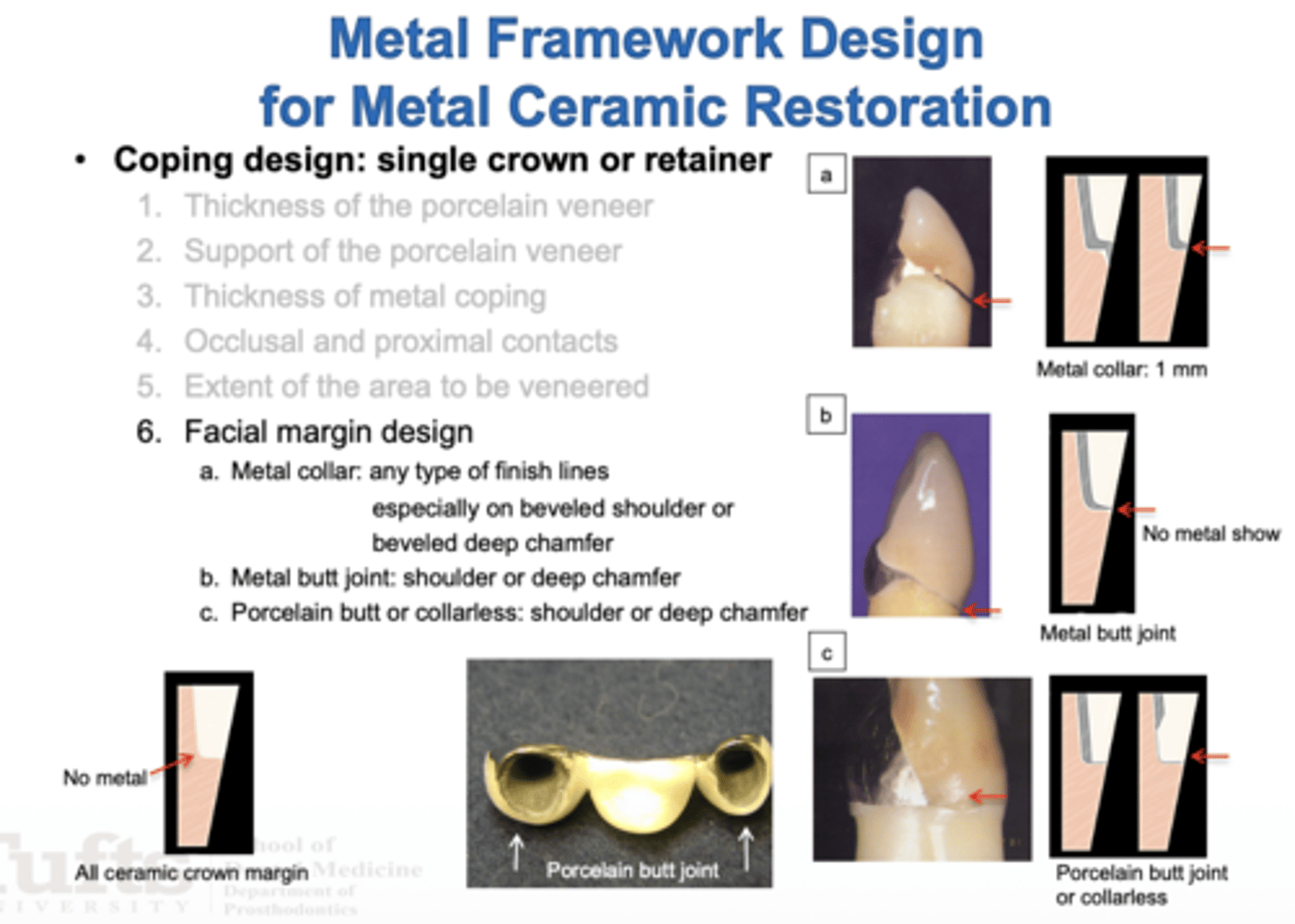 <p>Shoulder or deep chamfer</p>