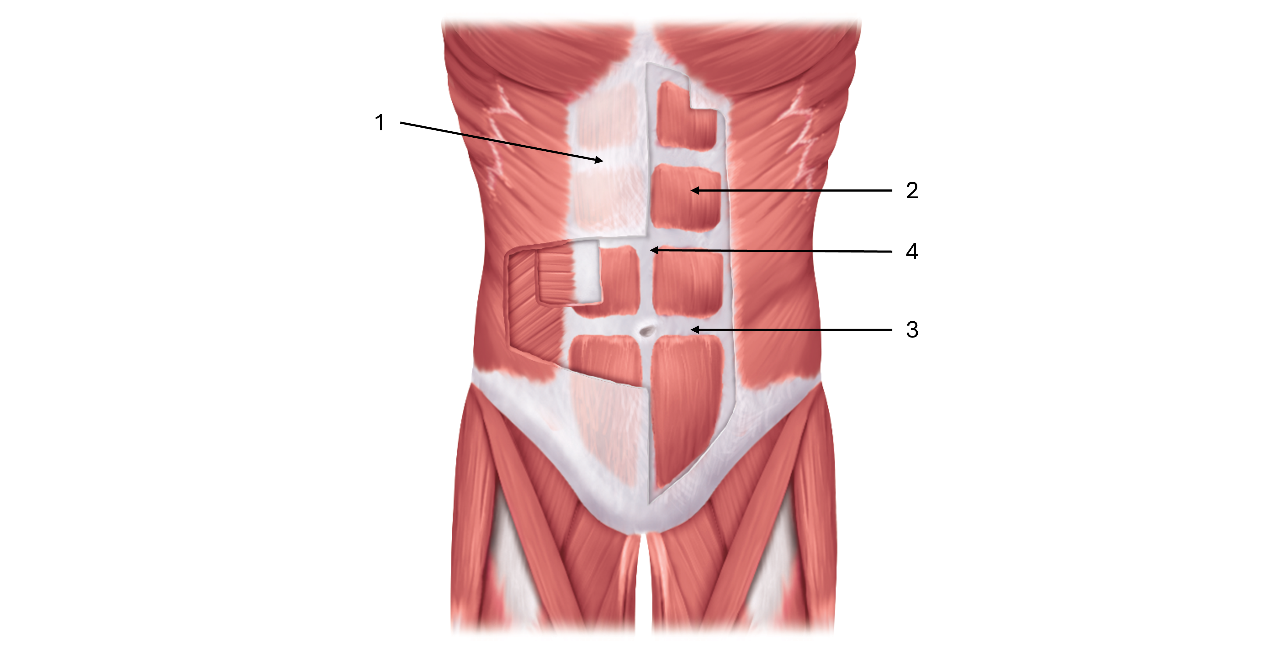 <p>label this diagram of the rectus abdominus </p>