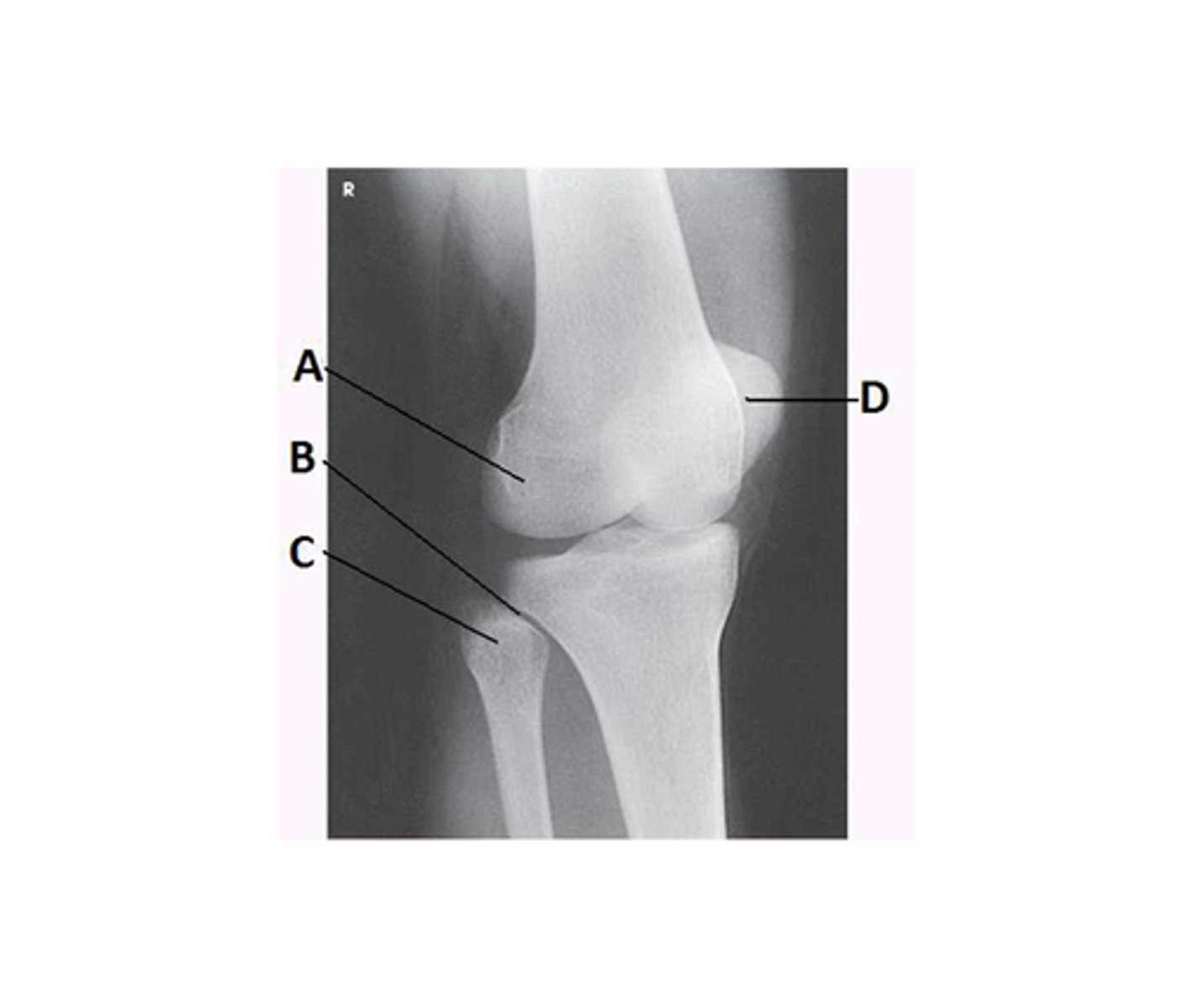 <p>What anatomy is labeled with the letter B in the image below?</p>