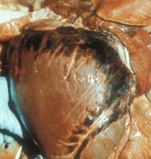 <p>What blood vessel disorder is due to anoxia, toxemia, agonal, or deficiency in vitamin E-Se for pigs? It appears as petechia, ecchymoses, or suffusive, is found in the epicardium and pericardium, and can involve the myocardium, such as in mulberry heart disease.</p>