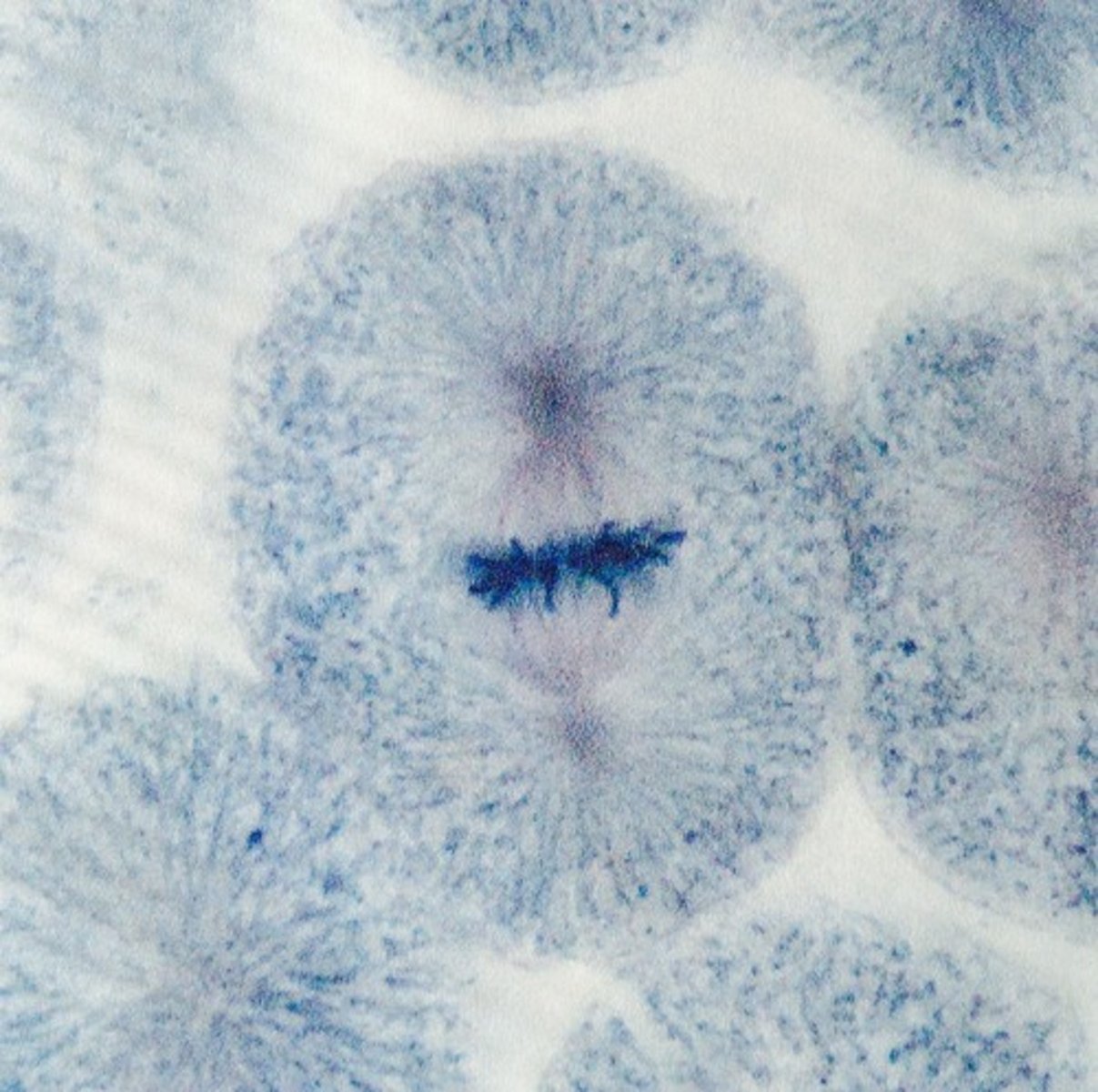 <p>- A fully formed spindle is visible which stretches from pole to pole. Each chromosome is attached to a spindle fiber at the centromere (kinetochore), and all the chromosomes are lined up in the equator.</p>