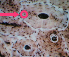 <p><span>bone cells</span></p><p>black dots within the osteon</p>