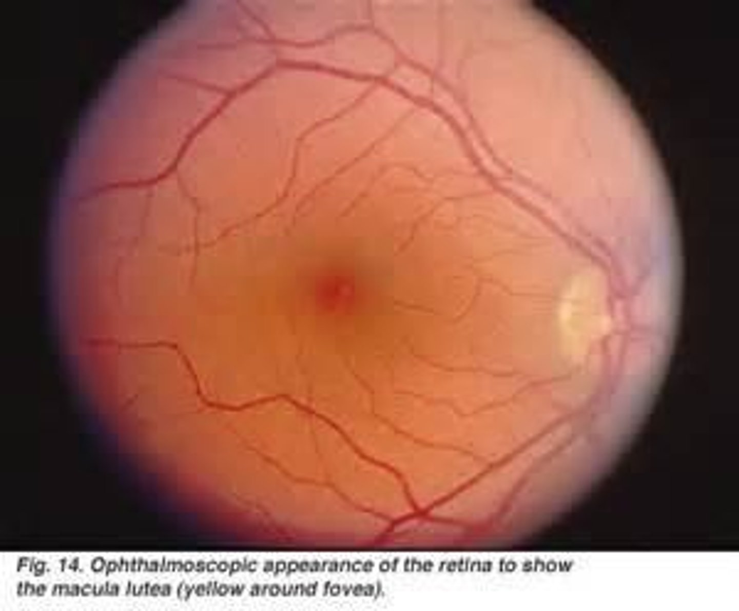 <p>It is the area of the retina with the highest concentration of cones, responsible for sharp central vision.</p>