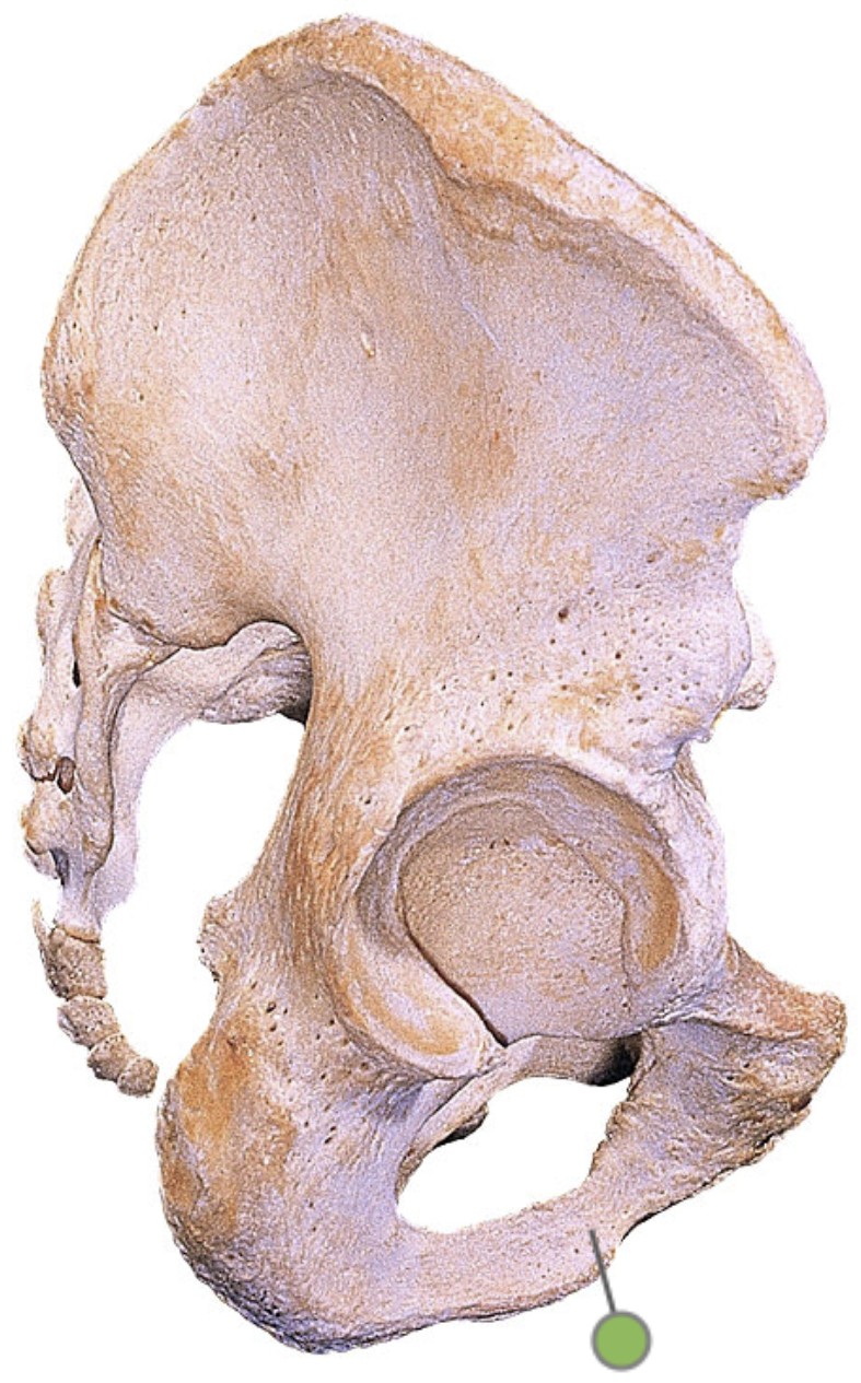 <p>Which bone landmark of the pelvic girdle is inferior to the superior pubic ramus?</p>