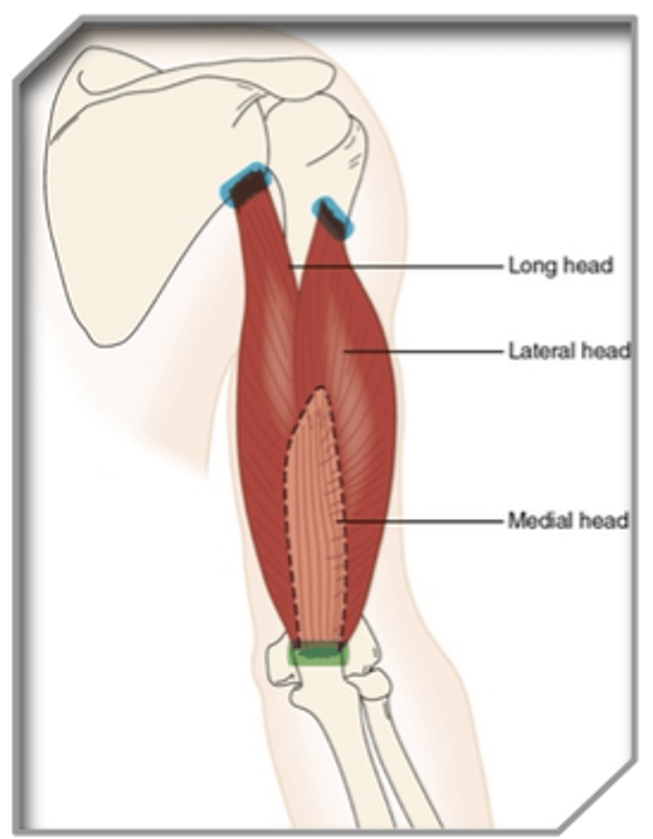 <p>What muscle is this?</p>