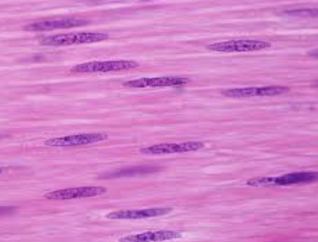 <p>What kind of muscle is this</p>