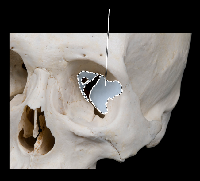 <p>Name this bone.</p><p>(Bones that form the orbit).</p>